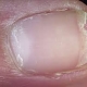 nail.jpg