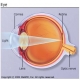 Multiple_Sclerosis_Vision_Problems.jpg