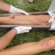 splint.ems_.jpg